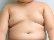 Obesitas Anak Mengancam Masa Depan Dunia